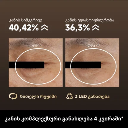 Dreame Chrona Pro Photon Anti-Aging Skincare Mask - სურათი 3